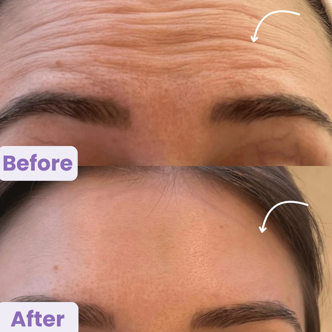 LuxeLift Pro™ Gua Sha – Your 5-Minute Face Fix