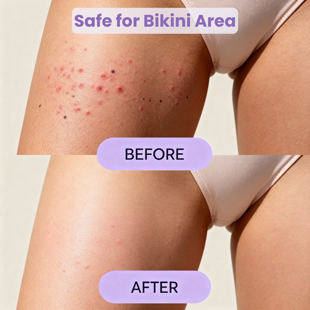 2-in-1 Painless Bikini Hair Trimmer